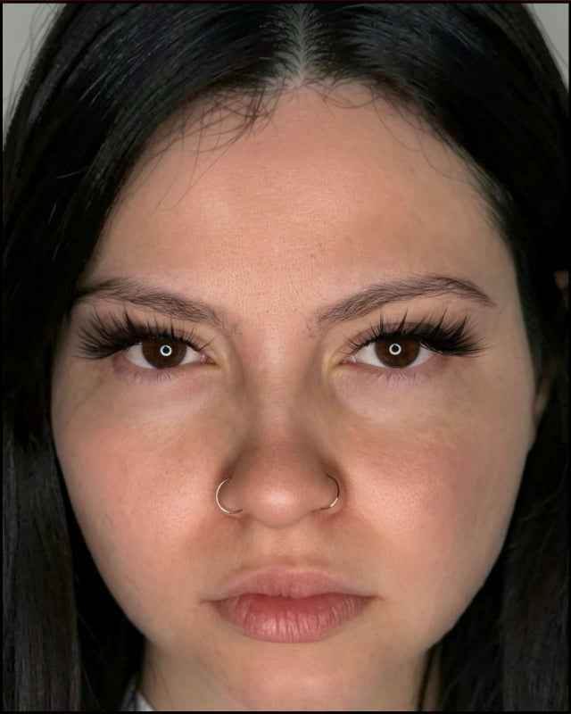 EFECTO MEDUSA